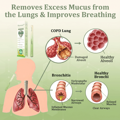 Produs românesc de calitate, livrare în țară 🥇 Inhalator Murwon® pentru plămâni 🍏(👨‍⚕️ Ajutor în tuse, inflamație, dispnee, expectorație, nas înfundat, bronșită și alergii) ❤️