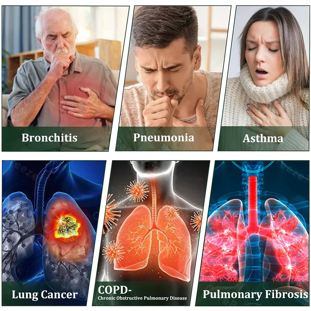 Produs românesc de calitate, livrare în țară 🥇 Inhalator Murwon® pentru plămâni 🍏(👨‍⚕️ Ajutor în tuse, inflamație, dispnee, expectorație, nas înfundat, bronșită și alergii) ❤️